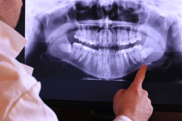 Best Emergency Root Canal Treatment in Bluefield, WV